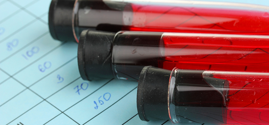 Tips to Finding a Dependable and Accurate Lab for Your Patients Blood Testing