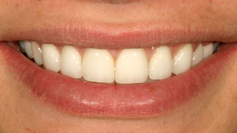 How Dentistry Can Beautify Your Smile Best Articles Site