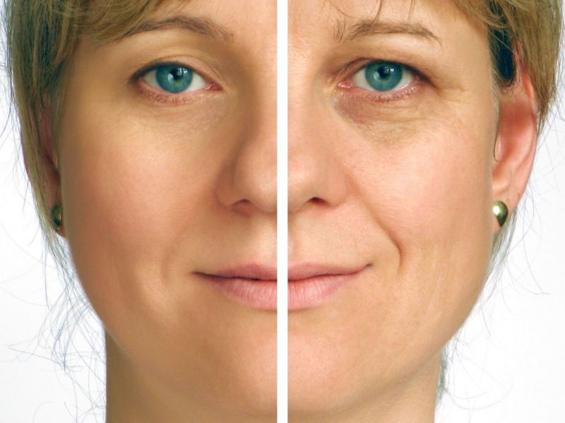 Anti-Aging in Texas to Feel Young Again